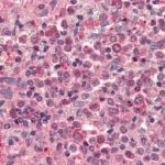 CI0116: IHC. Anti-Mouse CxCr4. Cross Reactivity in Human Spleen