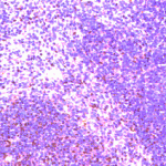 CI0123: Mouse CCR8. Immunohistochemistry on paraffin section of mouse spleen