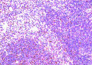 CI0123: Mouse CCR8. Immunohistochemistry on paraffin section of mouse spleen