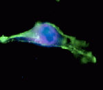 Human Spleen, Inhibition of TECK-induced activation of ES-2, TECK-Induced Activation of ES-2