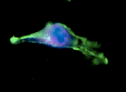 Human Spleen, Inhibition of TECK-induced activation of ES-2, TECK-Induced Activation of ES-2