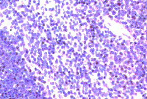 CI0125: IH paraffin section mouse spleen