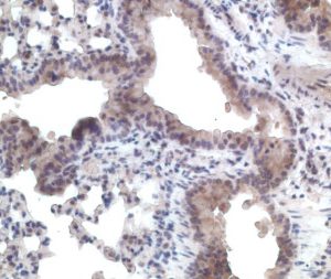 IH with anti-CCR11 paraffin section mouse lung