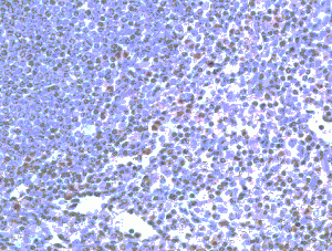 IH of TLR2 on human spleen