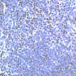 IH of TLR5 on human spleen paraffin