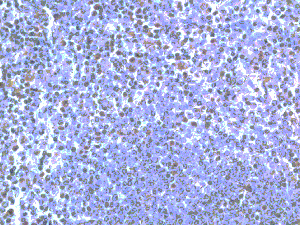 IH of TLR5 on human spleen paraffin