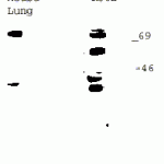 CI0136: Antibody binds to a approximately 75 KD protein in mouse lung. As expected most of the protein in human tumor cell lines K562 is degraded. Lane 1- Mouse Lung Lane 2- Human Cell Line K562