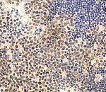 Immunohistochemistry with goat anti-IL-22 antibody on paraffin section of human tonsil