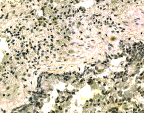 IH: Human lung IL-21r N-Term