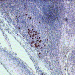 IH: Human tonsil. Hu IL22r Alpha 1(above) IH: Human spleen. Hu IL-22r Alpha 1 (below)