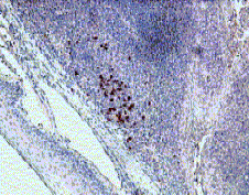 IH: Human tonsil. Hu IL22r Alpha 1(above) IH: Human spleen. Hu IL-22r Alpha 1 (below)