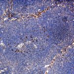 IH on mouse thymus with F(ab')2 rabbit antibody to mouse IL-21 receptor