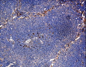 IH on mouse thymus with F(ab')2 rabbit antibody to mouse IL-21 receptor