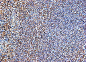 IH: TLR4 human spleen (above). IH: TLR4 mouse spleen (below left). IH: TLR4 human tonsil (below right).