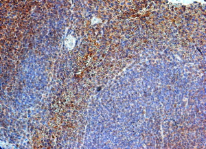 IH: TLR8 on mouse spleen (above). IH: TLR8 on Human tonsil (below).