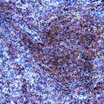 IH: TLR9 mouse spleen (above). IH: TLR9 human Tonsil (below left) IH: TLR9 human spleen (below right).