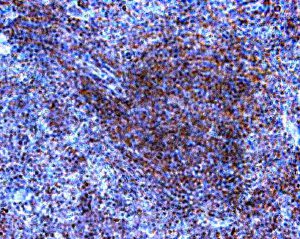 IH: TLR9 mouse spleen (above). IH: TLR9 human Tonsil (below left) IH: TLR9 human spleen (below right).