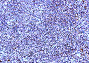 IH: TLR10 Human Spleen (above). IH: TLR10 Human Tonsil (below).