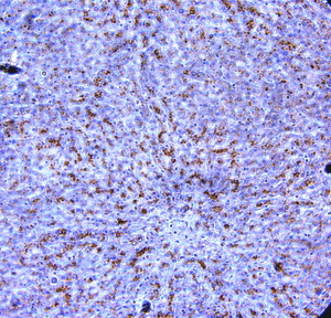 CI0164: AdipoR1 C-terminus human liver (above) IH paraffin, AdipoR1 C-terminus human muscle IH Paraffin (below).