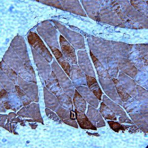 IH paraffin section mouse muscle with anti-Adipo R2 N-terminal region antibody (Top)IH paraffin section mouse liver with anti-Adipo R2 N-terminal region antibody (Bottom)