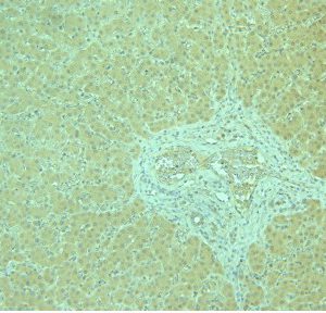 CI0168: Antibody to human ADPR1 receptor C-terminus on paraffin section of human liver (above) and on paraffin section of human muscle (below).