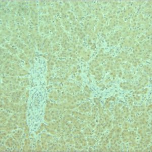 CI 0170: Antibody to human ADPR2 receptor C-terminus aa 321-342 on paraffin section of human liver (above) and on paraffin section of human muscle (below).