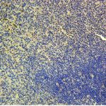 CI0171: Immunohistochemistry with CCR D6 Biotin Conjugate antibody to human Chemokine Receptor D6 on paraffin sections of human spleen.