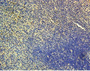 CI0171: Immunohistochemistry with CCR D6 Biotin Conjugate antibody to human Chemokine Receptor D6 on paraffin sections of human spleen.