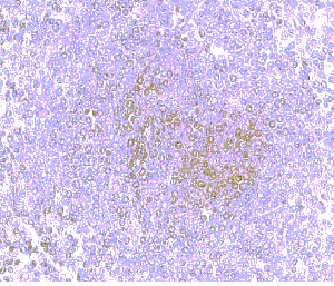 Anti-Human CCR8 2nd extracellular domain